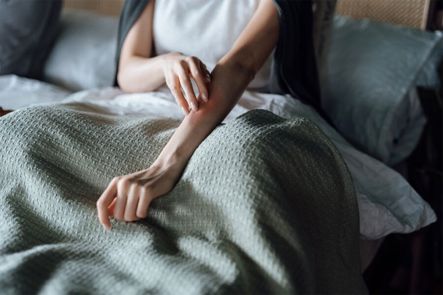 Rashes Treatment in Bridgewater, NJ | Curated Dermatology